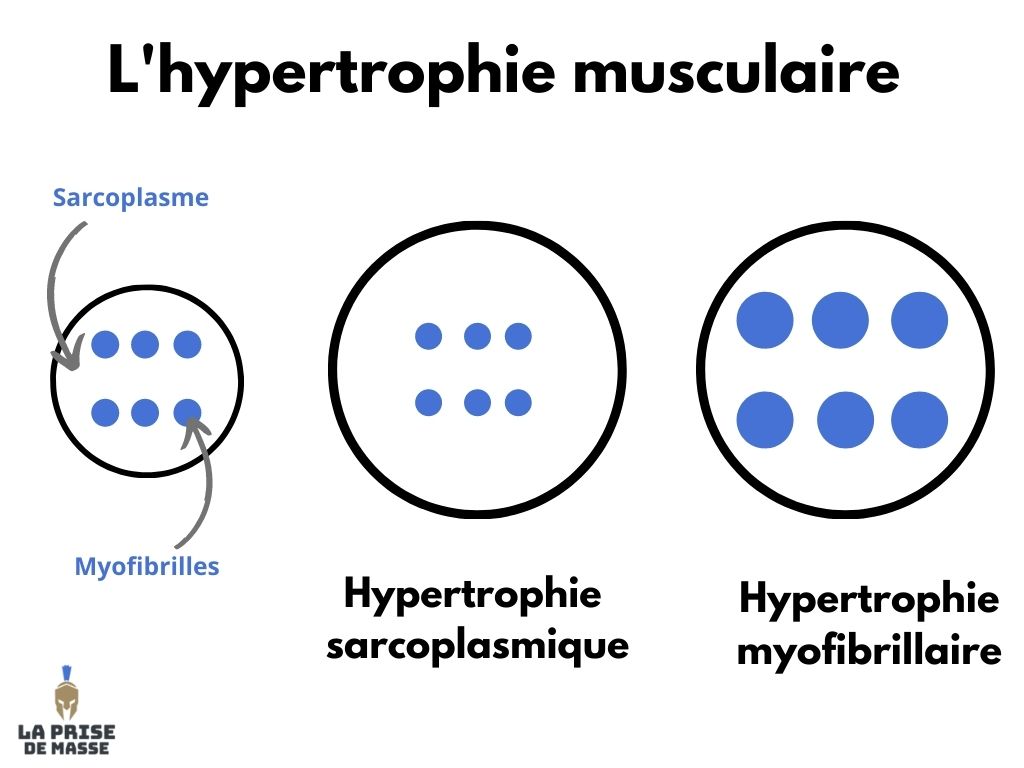 Hypertrophie sarcoplasmique et myofibrillaire